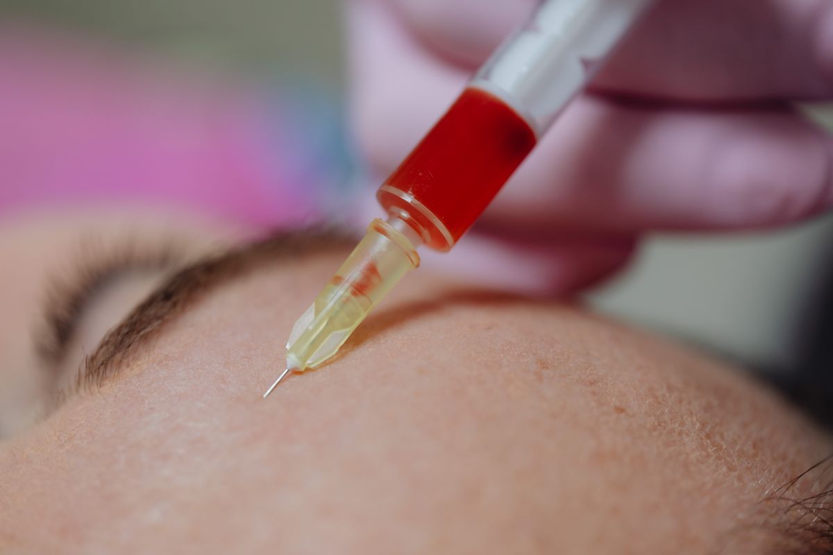 汶上玻尿酸填充剂怎么选:分子量、交联度与注册证解读
